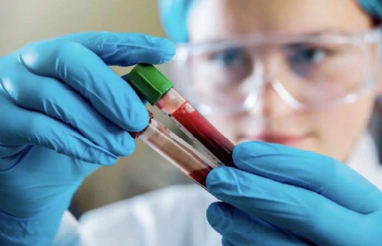 Quanto costa un esame del sangue privato e cosa c’è da sapere su tempistiche e risultati