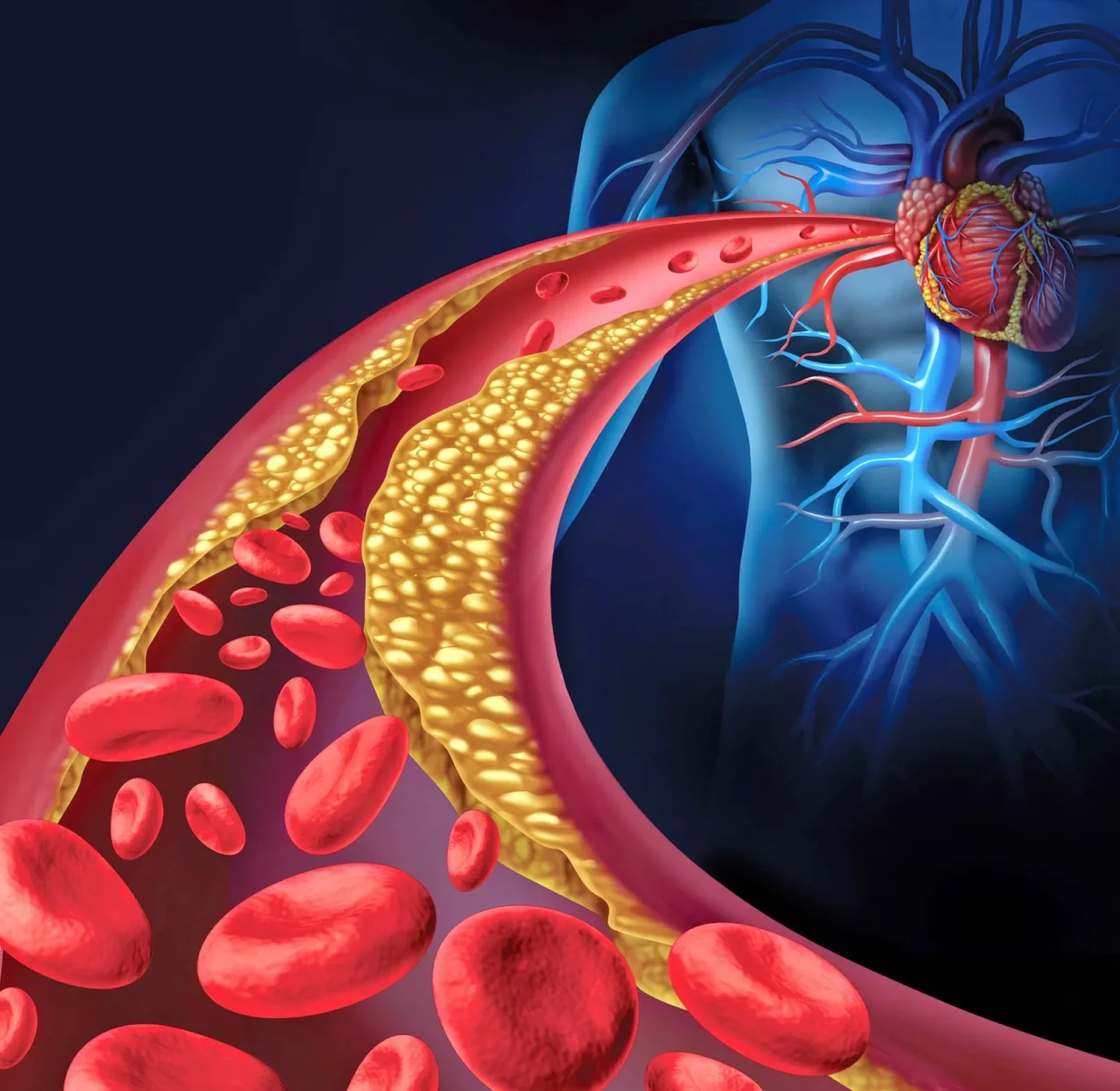 I 10 migliori alimenti per mantenere le arterie pulite: ecco quali sono